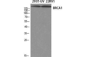Western Blot (WB) analysis of specific cells using BRCA1 Polyclonal Antibody. (BRCA1 抗体  (Ser184, Ser186))