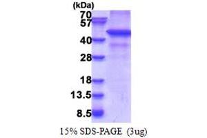 SDS-PAGE (SDS) image for Ring Finger Protein 34 (RNF34) (AA 1-373) protein (His tag) (ABIN5853359)