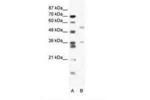 Image no. 1 for anti-BTB (POZ) Domain Containing 3 (BTBD3) (AA 349-398) antibody (ABIN203194) (BTBD3 抗体  (AA 349-398))