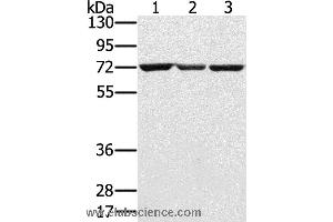 Western blot analysis of Hepg2, A172 and Raji cell, using SLC25A13 Polyclonal Antibody at dilution of 1:450 (slc25a13 抗体)