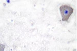 Immunohistochemistry analyzes of GAS3 antibody in paraffin-embedded human brain tissue. (PMP22 抗体)