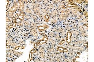 ABIN7093243 and ABIN7097260 at 1/100 staining Rat kidney tissue by IHC-P. (IRF7 抗体  (pSer479))