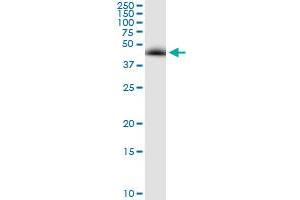 Immunoprecipitation of NEK2 transfected lysate using anti-NEK2 MaxPab rabbit polyclonal antibody and Protein A Magnetic Bead , and immunoblotted with NEK2 purified MaxPab mouse polyclonal antibody (B01P) . (NEK2 抗体  (AA 1-445))