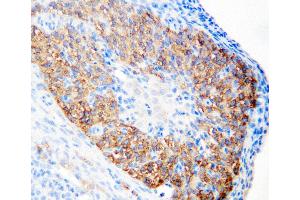 Anti-hCG receptor antibody, IHC(P) IHC(P): Rat Ovary Tissue (LHCGR 抗体  (N-Term))