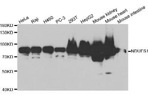 Western blot analysis of extracts of various cell lines, using NDUFS1 antibody (ABIN5971414) at 1/1000 dilution. (NDUFS1 抗体)