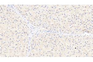 Detection of ITIH4 in Human Liver Tissue using Polyclonal Antibody to Inter Alpha-Globulin Inhibitor H4 (ITIH4) (ITIH4 抗体  (AA 273-424))