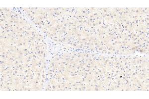 Detection of ITIH4 in Human Liver Tissue using Polyclonal Antibody to Inter Alpha-Globulin Inhibitor H4 (ITIH4)