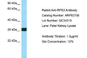 Western Blotting (WB) image for anti-Ribosomal Protein S3 (RPS3) (C-Term) antibody (ABIN2789596) (RPS3 抗体  (C-Term))