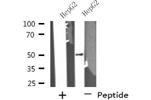 Western blot analysis of extracts from HepG2 cells using PPP4R1L antibody. (PPP4R1L 抗体)