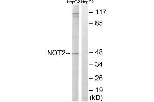 Western blot analysis of extracts from HepG2 cells, treated with starved (24hours), using CNOT2 (epitope around residue 101) antibody. (CNOT2 抗体  (Ser101))