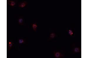 ABIN6269258 staining Hep G2 cells by IF/ICC. (GATA4 抗体  (Internal Region))