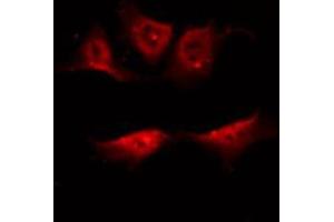 ABIN6267408 staining NIH-3T3 by IF/ICC. (PKC 抗体  (pThr497))