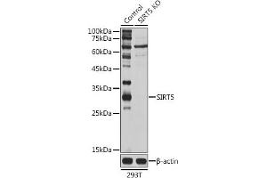 Western blot analysis of extracts of 293T cells, using SIRT5 antibody (ABIN6129331, ABIN6147798, ABIN6147799 and ABIN6221468) at 1:1000 dilution. (SIRT5 抗体  (AA 1-310))