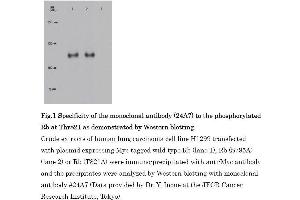 Western Blotting (WB) image for anti-Retinoblastoma 1 (RB1) (pThr821) antibody (ABIN3201013)