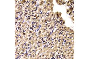 Immunohistochemistry (Paraffin-embedded Sections) (IHC (p)) image for anti-Chaperonin Containing TCP1, Subunit 4 (Delta) (CCT4) (AA 130-390) antibody (ABIN6138108)