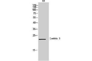 Western Blotting (WB) image for anti-Immunoglobulin lambda-Like Polypeptide 1 (IGLL1) (Internal Region) antibody (ABIN3181479) (IGLL1 抗体  (Internal Region))