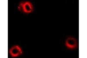 Immunofluorescent analysis of APEH staining in Hela cells. (APEH 抗体)