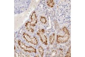 Immunohistochemical staining of human kidney with XPNPEP2 polyclonal antibody  shows distinct membranous positivity in tubular cells at 1:50-1:200 dilution.