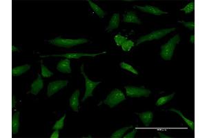 Immunofluorescence of purified MaxPab antibody to PSME3 on HeLa cell. (PSME3 抗体  (AA 1-254))
