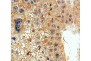 Used in DAB staining on fromalin fixed paraffin-embedded Liver tissue (EPO 抗体  (AA 28-193))