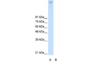 WB Suggested Anti-ZBTB38 Antibody Titration:  2. (ZBTB38 抗体  (N-Term))