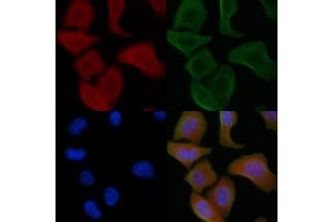 ABIN6259791 and ABIN6266850 staining Hela cells by IF/ICC. (ADCK1 抗体  (Internal Region))