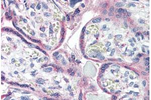 Anti-CXCR1 antibody  ABIN1048470 IHC staining of human placenta. (CXCR1 抗体  (Internal Region))