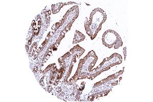 Duodenum exhibiting significant granular cytoplasmic SDHB staining in epithelial cells predominantly in the sub apical cell compartments (Recombinant SDHB 抗体)