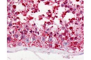 Immunohistochemical (Formalin/PFA-fixed paraffin-embedded sections) staining in human testis with GPR18 polyclonal antibody . (GPR18 抗体)