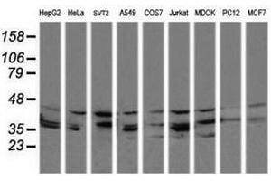 Image no. 1 for anti-Mitogen-Activated Protein Kinase Kinase 3 (MAP2K3) antibody (ABIN1499398) (MAP2K3 抗体)