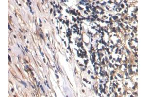 DAB staining on IHC-P; Samples: Human Lymph node Tissue (CTGF 抗体  (AA 248-349))