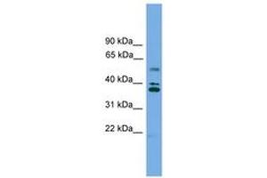 Image no. 1 for anti-Low Density Lipoprotein Receptor Class A Domain Containing 3 (LDLRAD3) (AA 143-192) antibody (ABIN6745022) (LDLRAD3 抗体  (AA 143-192))