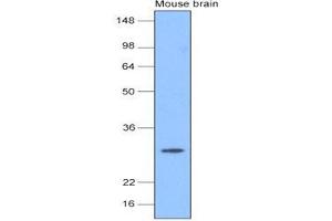 The extracts of mouse brain (20 ug) were resolved by SDS-PAGE, transferred to nitrocellulose membrane and probed with anti-human PGP9. (UCHL1 抗体  (AA 1-223))