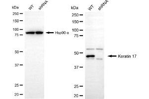 Western blotting analysis using keratin 17 antibody (ABIN7799171). (KRT17 抗体)