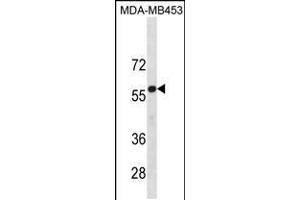 Western blot analysis in MDA-MB453 cell line lysates (35ug/lane). (UGT2B4 抗体  (N-Term))