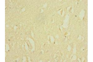 Immunohistochemistry (IHC) image for anti-Sodium Channel, Voltage-Gated, Type VIII, alpha (SCN8A) (AA 1350-1440) antibody (ABIN7169928)