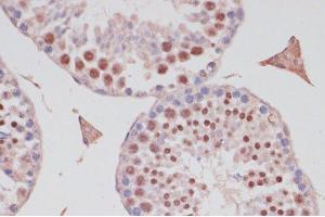 Immunohistochemistry (Paraffin-embedded Sections) (IHC (p)) image for anti-S100 Calcium Binding Protein P (S100P) antibody (ABIN7258128)
