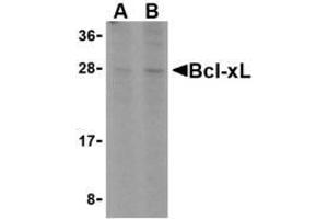 Western blot analysis of Bcl-xL in A549 cell lysates with AP30132PU-N Bcl-xL antibody at (A) 1 and (B) 2 μg/ml. (BCL2L1 抗体)
