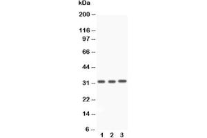 Western blot testing of Caspase-3 antibody and Lane 1:  rat liver;  2: rat thymus;  3: SMMC-7721 (Caspase 3 抗体  (AA 67-175))