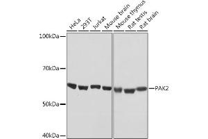 Western blot analysis of extracts of various cell lines, using P Rabbit mAb (ABIN7269146) at 1:1000 dilution.