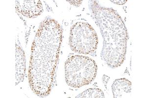 Immunohistochemistry (IHC) image for anti-Sp1 Transcription Factor (SP1) (AA 250-300) antibody (ABIN7795788) (Recombinant SP1 抗体  (AA 250-300))