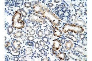 ZRSR2 antibody was used for immunohistochemistry at a concentration of 4-8 ug/ml to stain Epithelial cells of renal tubule (arrows) in Human Kidney. (ZRSR2 抗体)