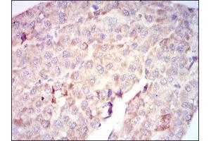 Immunohistochemistry (IHC) image for anti-V-Raf-1 Murine Leukemia Viral Oncogene Homolog 1 (RAF1) antibody (ABIN1844891) (RAF1 抗体)