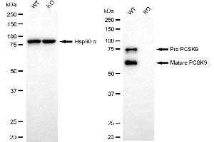 Western blotting analysis using PCSK9 antibody (ABIN7799929).