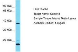 Image no. 1 for anti-Calcium/calmodulin-Dependent Protein Kinase ID (CAMK1D) (AA 39-88) antibody (ABIN6750384) (CAMK1D 抗体  (AA 39-88))