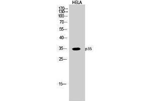 Western Blotting (WB) image for anti-P35 (N-Term) antibody (ABIN3176715) (P35 (N-Term) 抗体)