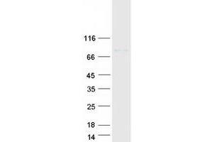 Western Blotting (WB) image for Solute Carrier Family 3 Member 1 (SLC3A1) protein (Myc-DYKDDDDK Tag) (ABIN2732174)