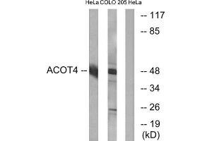 Western Blotting (WB) image for anti-Acyl-CoA Thioesterase 4 (ACOT4) (C-Term) antibody (ABIN1850684) (ACOT4 抗体  (C-Term))