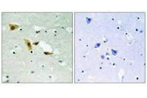 Immunohistochemistry analysis of paraffin-embedded human brain tissue using APLF (Ab-116) antibody. (APLF 抗体  (Ser116))