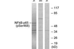 Western Blotting (WB) image for anti-Nuclear Factor-kB p65 (NFkBP65) (pSer468) antibody (ABIN2888488) (NF-kB p65 抗体  (pSer468))